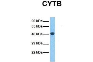 Host:  Rabbit  Target Name:  CYTB  Sample Tissue:  Human Fetal Liver  Antibody Dilution:  1. (Cytochrome b antibody  (N-Term))