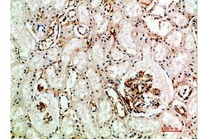 Immunohistochemical analysis of paraffin-embedded human-kidney, antibody was diluted at 1:200 (Endoglin antibody  (AA 370-430))
