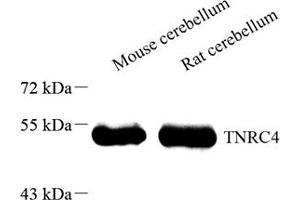 Western blot analysis of CELF3 (ABIN7073603),at dilution of 1: 2000 (CELF3 antibody)