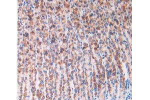 IHC-P analysis of stomach tissue, with DAB staining. (IL1R1 antibody  (AA 119-217))