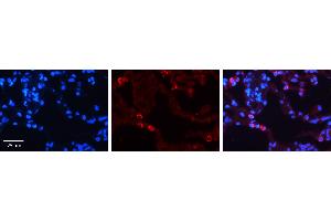 Immunohistochemistry (IHC) image for anti-Prolyl 4-Hydroxylase, beta Polypeptide (P4HB) (C-Term) antibody (ABIN2783246)
