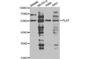 Western blot analysis of extracts of various cell lines, using PLAT antibody (ABIN5973300) at 1/1000 dilution. (PLAT antibody)