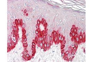Anti-SIRT1 antibody IHC of human skin. (SIRT1 antibody  (AA 577-590))