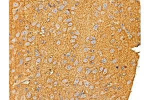 ABIN6258684 and ABIN6274829 at 1/100 staining Rat brain tissue by IHC-P. (AKR1E2 antibody  (Internal Region))