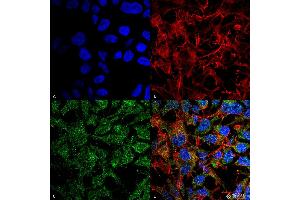 Immunocytochemistry/Immunofluorescence analysis using Rabbit Anti-BDNF Polyclonal Antibody . (BDNF antibody  (N-Term) (APC))