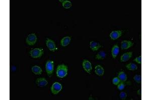 Immunofluorescent analysis of A549 cells using ABIN7171008 at dilution of 1:100 and Alexa Fluor 488-congugated AffiniPure Goat Anti-Rabbit IgG(H+L) (SOCS6 antibody  (AA 1-210))