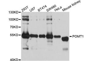 Western blot analysis of extracts of various cell lines, using POMT1 antibody (ABIN5998570) at 1/1000 dilution. (POMT1 antibody)
