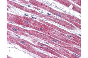 NDUFAF2 antibody  (C-Term)