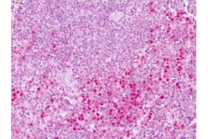 Immunohistochemistry (IHC) image for anti-Protein tyrosine Phosphatase, Receptor Type, E (PTPRE) (Cytoplasmic Domain) antibody (ABIN1049273)