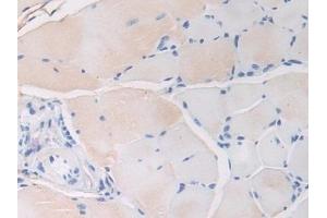 Immunohistochemistry (IHC) image for anti-Fibrillin 1 (FBN1) (AA 1703-1889) antibody (ABIN7438445)