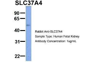 Host:  Rabbit  Target Name:  SLC37A4  Sample Type:  Human Fetal Kidney  Antibody Dilution:  1. (SLC37A4 antibody  (Middle Region))