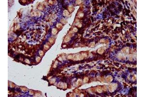 IHC image of ABIN7149870 diluted at 1:400 and staining in paraffin-embedded human small intestine tissue performed on a Leica BondTM system. (SAT2 antibody  (AA 1-170))