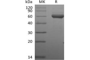 Western Blotting (WB) image for Butyrophilin, Subfamily 3, Member A1 (BTN3A1) protein (Biotin) (ABIN7319892) (BTN3A1 Protein (Biotin))