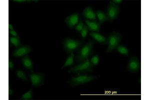 Immunofluorescence of monoclonal antibody to OXSR1 on HeLa cell. (OXSR1 antibody  (AA 1-527))
