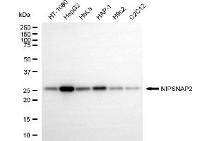Western blotting analysis using NIPSNAP2 antibody (ABIN7798724).