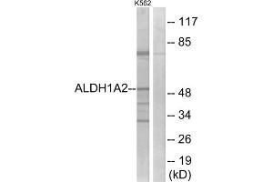 Western blot analysis of extracts from K562 cells, using ALDH1A2 antibody. (ALDH1A2 antibody  (C-Term))