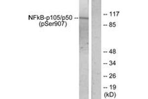 Western blot analysis of extracts from HeLa cells treated with TNF-alpha, using NF-kappaB p105/p50 (Phospho-Ser907) Antibody. (NFKB1 antibody  (pSer907))