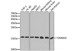 Western blot analysis of extracts of various cell lines, using TOMM20 antibody. (TOMM20 antibody)