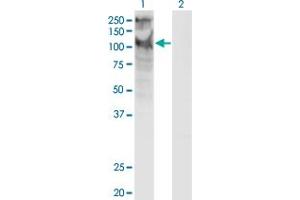Western Blot analysis of TRPC5 expression in transfected 293T cell line by TRPC5 monoclonal antibody (M10), clone 1C8. (TRPC5 antibody  (AA 534-603))