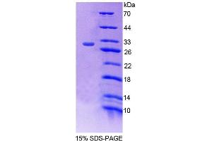 SDS-PAGE (SDS) image for Propionyl CoA Carboxylase beta Polypeptide (PCCB) (AA 311-541) protein (His tag) (ABIN4989972) (PCCB Protein (AA 311-541) (His tag))