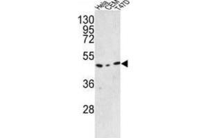 Western Blotting (WB) image for anti-Chromosome 9 Open Reading Frame 156 (C9orf156) antibody (ABIN3002894) (C9orf156 antibody)