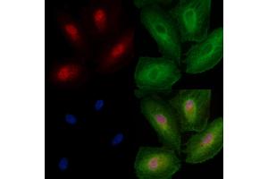 ABIN6257561 and ABIN6274179 staining  cells by IF/ICC.