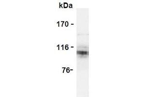 Western Blotting (WB) image for anti-Amyloid beta (A4) Precursor Protein (APP) (AA 18-38) antibody (ABIN1449275) (APP antibody  (AA 18-38))