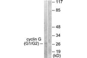 Western blot analysis of extracts from Jurkat cells, using Cyclin G Antibody. (Cyclin G1 antibody  (AA 161-210))