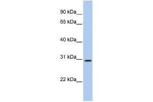 WB Suggested Anti-C20orf10 Antibody Titration: 0. (TP53TG5 antibody  (N-Term))