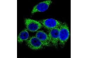 Confocal immunofluorescent analysis of phospho-TSC2 antibody with HeLa cells followed by Alexa Fluor 488-conjugated goat anti-rabbit lgG (green). (Tuberin antibody  (pSer1387))
