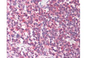 Anti-FTHFSDC1 / MTHFD1L antibody IHC staining of human tonsil. (MTHFD1L antibody  (AA 578-591))