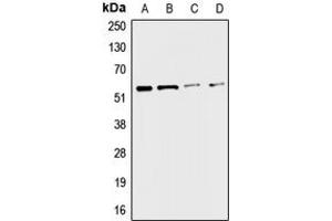 Western blot analysis of CHRNA3 expression in A549 (A), HepG2 (B), mouse liver (C), rat kidney (D) whole cell lysates. (CHRNA3 antibody  (Center))