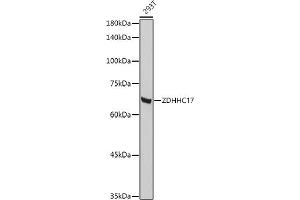 Western blot analysis of extracts of 293T cells, using ZDHHC17 antibody (ABIN6130455, ABIN6150416, ABIN6150417 and ABIN6222540) at 1:1000 dilution. (ZDHHC17 antibody  (AA 170-310))