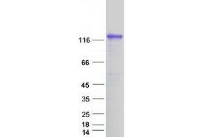 Western Blotting (WB) image for DAB2 Interacting Protein (DAB2IP) (Transcript Variant 1) protein (Myc-DYKDDDDK Tag) (ABIN2712272)