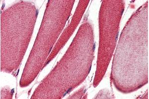 ABIN334342 (2µg/ml) staining of paraffin embedded Human Skeletal Muscle. (ALOX15 antibody  (Internal Region))