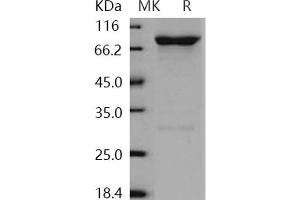 GRK6 Protein (GST tag,His tag)