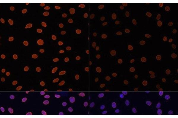 Histone H4 antibody  (acLys12)