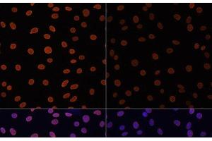Immunofluorescence analysis of C6 cells using Acetyl-Histone H4-K12 Polyclonal Antibody at dilution of 1:100. (Histone H4 antibody  (acLys12))