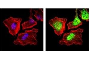 Immunofluorescence (IF) image for anti-Keratin 5 (KRT5) antibody (ABIN1106933) (Cytokeratin 5 antibody)