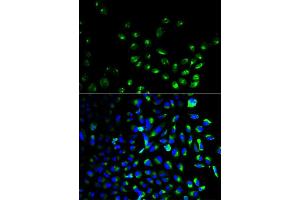 Immunofluorescence analysis of HeLa cell using UCHL1 antibody. (UCHL1 antibody)
