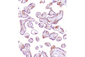 IHC analysis of RP2 using anti-RP2 antibody (ABIN6719513). (RP2 antibody  (AA 244-348))