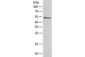 Western Blotting (WB) image for Protein Disulfide Isomerase Family A, Member 3 (PDIA3) (AA 25-505) protein (His tag) (ABIN7285819) (PDIA3 Protein (AA 25-505) (His tag))