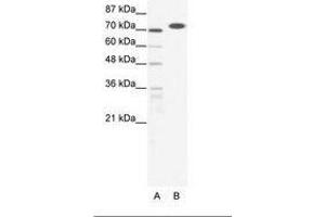 Image no. 1 for anti-RB-Associated KRAB Zinc Finger (RBAK) (AA 447-496) antibody (ABIN202880) (RBAK antibody  (AA 447-496))
