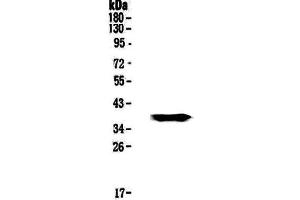 Western blot analysis of GALE using anti-GALE antibody . (GALE antibody  (AA 1-340))