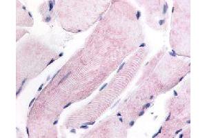 Immunohistochemical (Formalin/PFA-fixed paraffin-embedded sections) staining in human skeletal muscle with WNK1 polyclonal antibody . (WNK1 antibody)