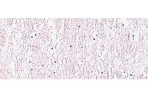 Immunohistochemistry of paraffin-embedded Human brain tissue using SMPD2 Polyclonal Antibody at dilution of 1:90(x200)