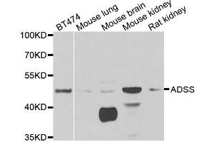Western blot analysis of extracts of various cell lines, using ADSS antibody.