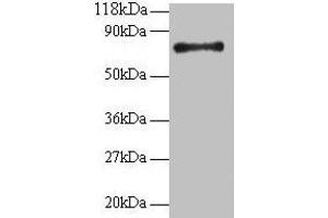 Western blot All lanes: RPS18 antibody at 2 μg/mL + 293T whole cell lysate Secondary Goat polyclonal to rabbit IgG at 1/15000 dilution Predicted band size: 18 kDa Observed band size: 75 kDa (RPS18 antibody  (AA 2-152))