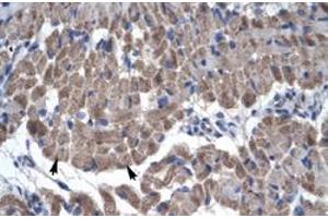 Immunohistochemical staining (Formalin-fixed paraffin-embedded sections) of human muscle with GAS7 polyclonal antibody  at 4-8 ug/mL working concentration. (GAS7 antibody  (N-Term))