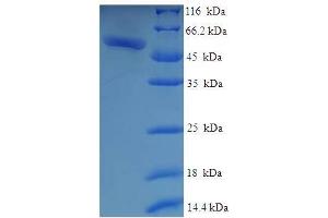 SDS-PAGE (SDS) image for Galactose Mutarotase (Aldose 1-Epimerase) (GALM) (AA 2-342) protein (His-SUMO Tag) (ABIN4975991) (GALM Protein (AA 2-342) (His-SUMO Tag))